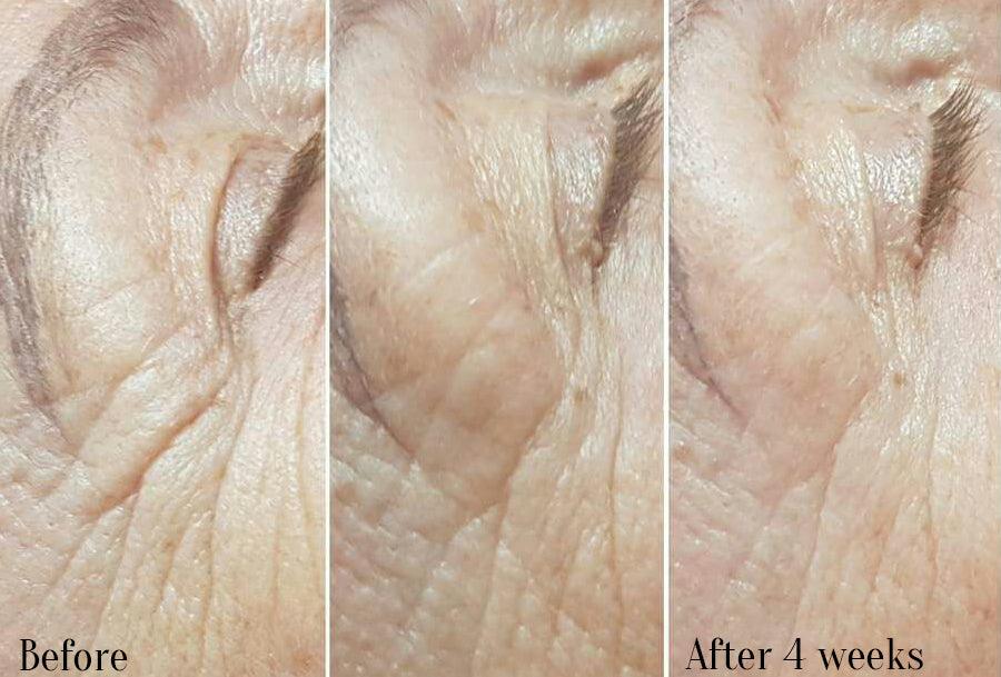 Hya 4 Deep Lift Q10 30ml